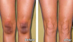 Face & Body Oil Spot Correcting & Brightening Hypoallergenic