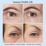Fast Anti Aging Eye Cream For Dark Circles