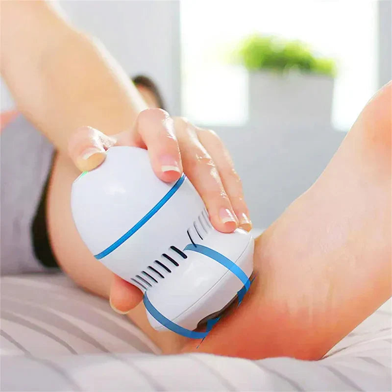 Effortless Electric Foot Callus Remover for Smooth Feet