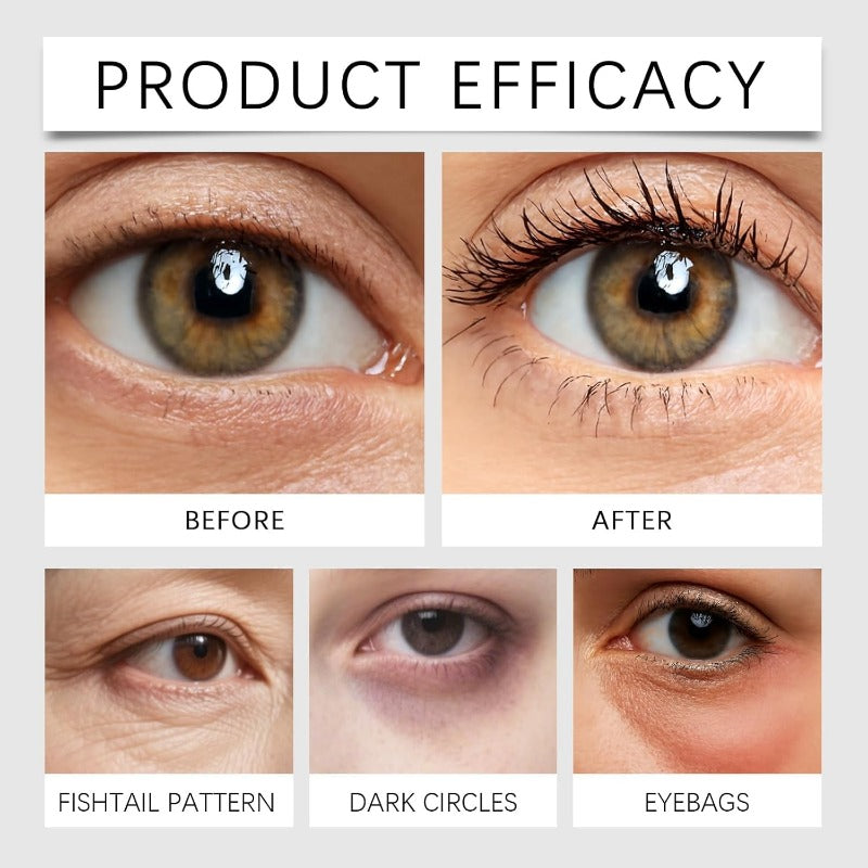 Fast Anti Aging Eye Cream For Dark Circles