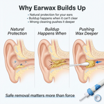 Easy Ear Cleaner Removal Kit for Safe Use