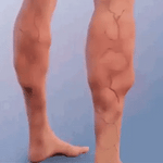 Leg Vein Spray Circulation-Boosting Swelling Relief