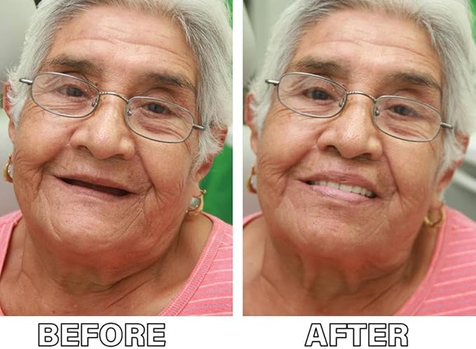 Silicone Dental Prosthetics for Comfortable, Natural Look