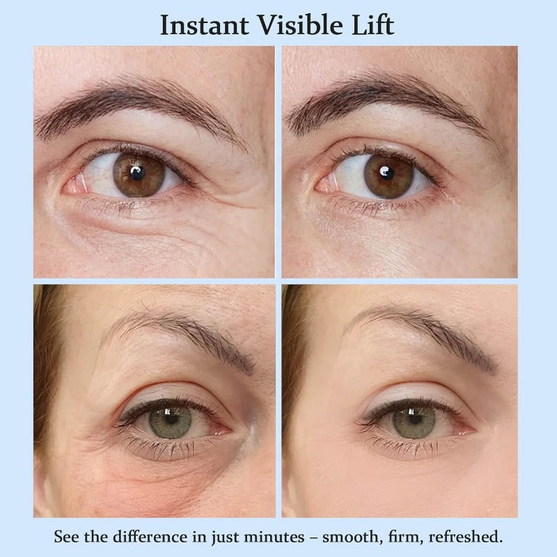 Fast Anti Aging Eye Cream For Dark Circles