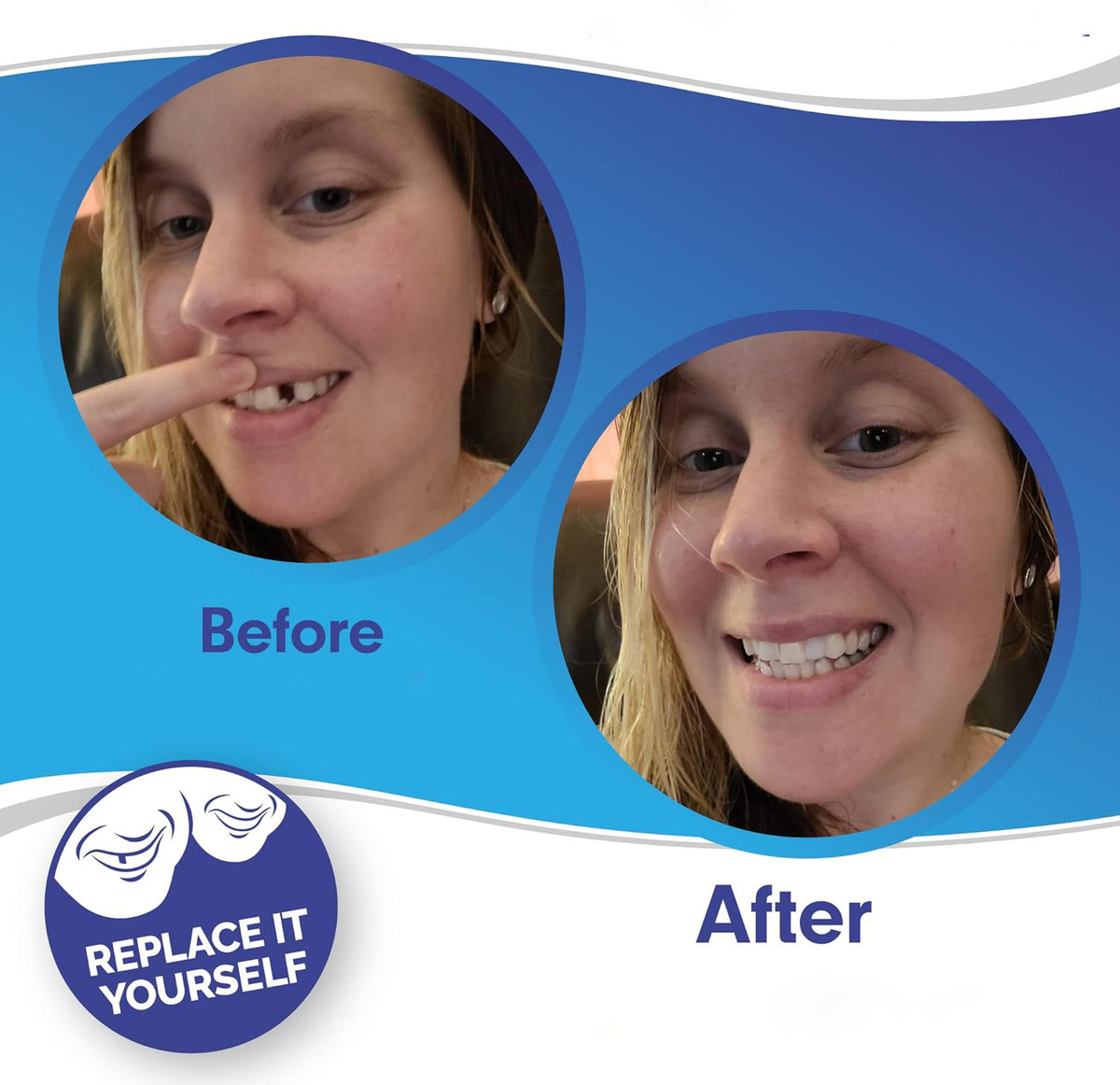 Cosmetic Tooth Covers Upper & Lower Set Instant Snap-On Dental Overlay for Natural Looking Smile Confidence Booster Reusable Teeth Caps