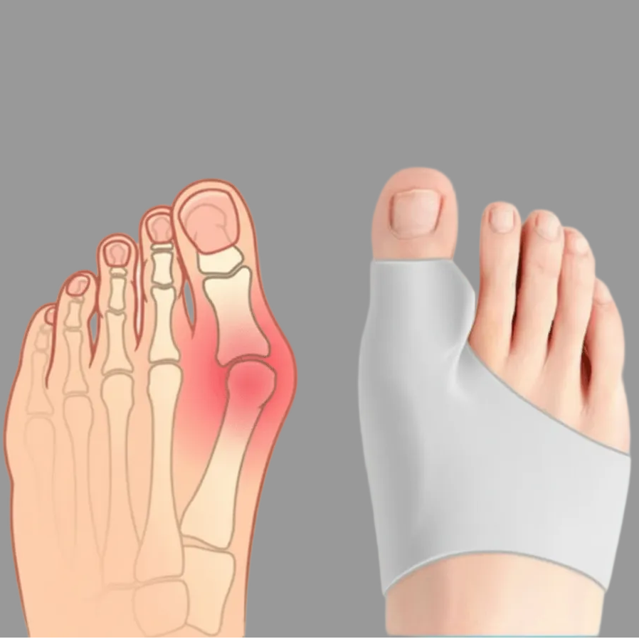 PODARA – Hallux Valgus Corrector for Everyday Comfort and Support