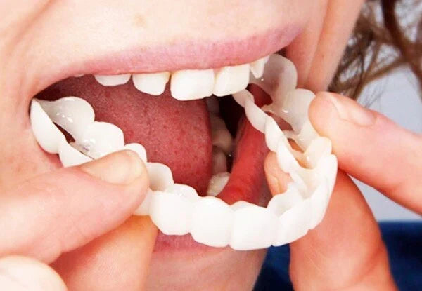 Removable Snap-On Veneers for Temporary Smile Makeover – Heat-Moldable Cosmetic Teeth Covers for Top Teeth