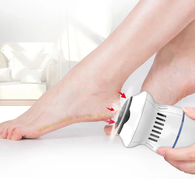 Effortless Electric Foot Callus Remover for Smooth Feet