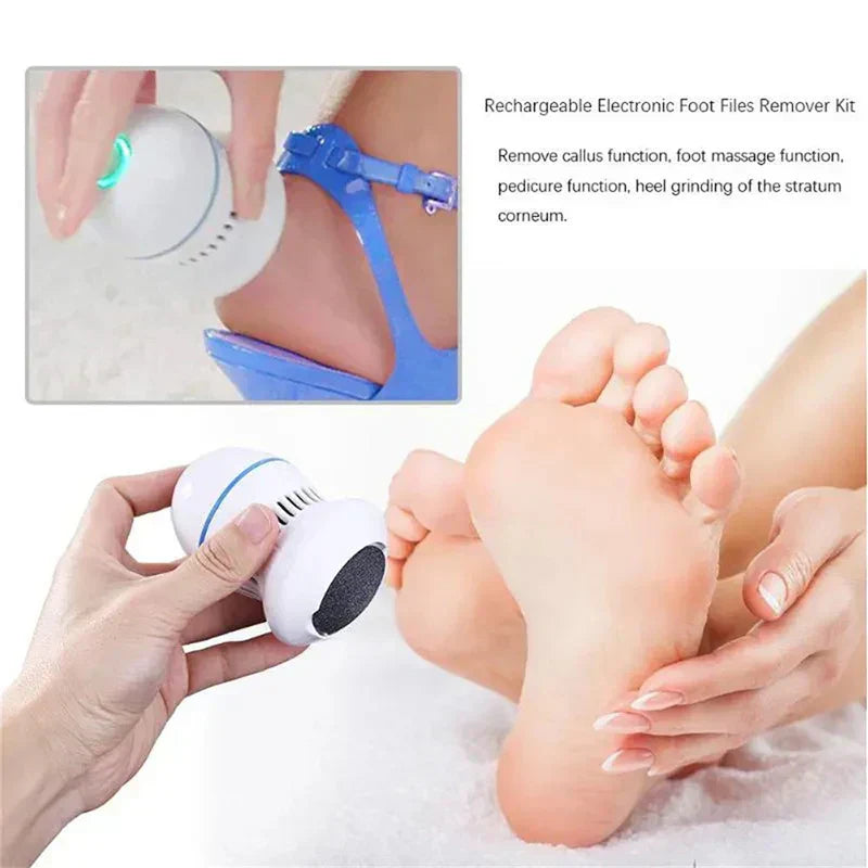 Effortless Electric Foot Callus Remover for Smooth Feet