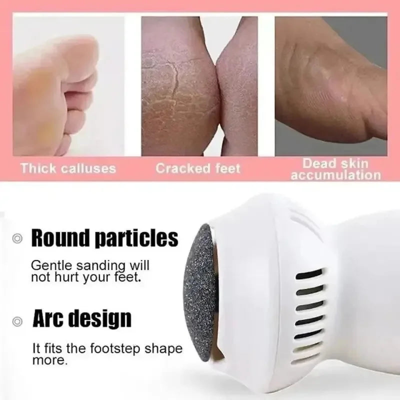 Effortless Electric Foot Callus Remover for Smooth Feet